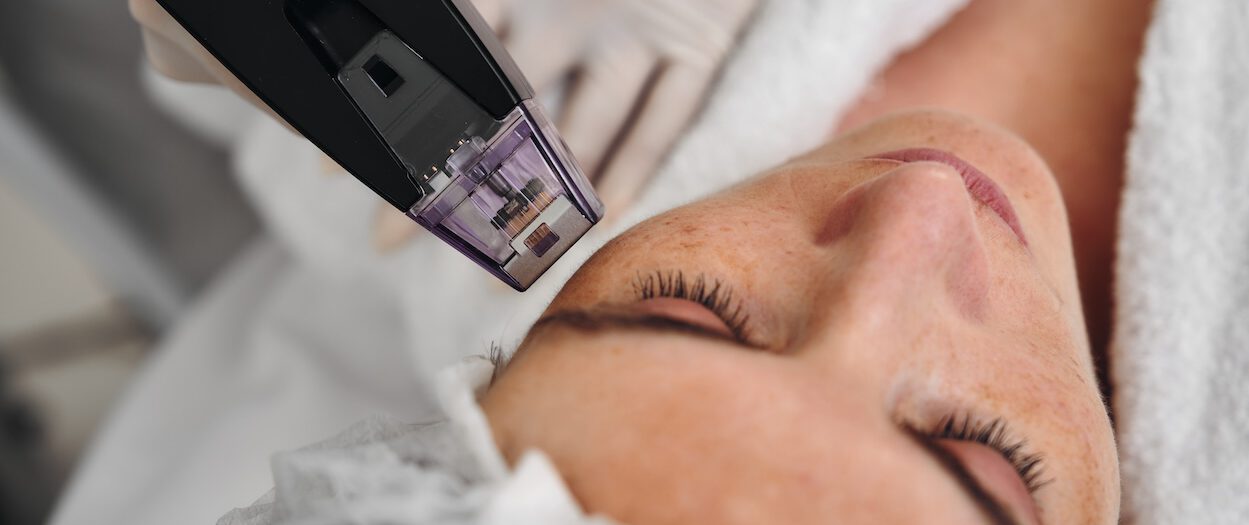 a woman receives rf lifting in a beauty salon 2026 01 08 07 24 03 utc e1773832199148